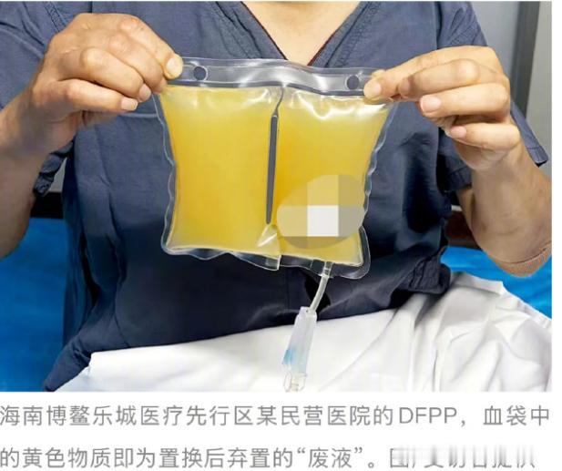 上海，一位42岁的大姐徐蓉（化名）花了不菲的价钱，亲身体验了一把“血液净化”，从