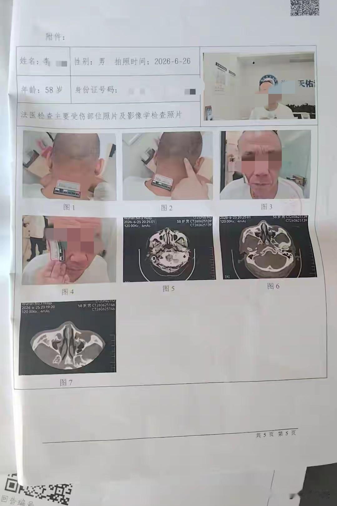 湖北武汉，一58岁男子在餐馆吃饭，邻桌三男一女吵得厉害，他提醒让对方小声一点，不