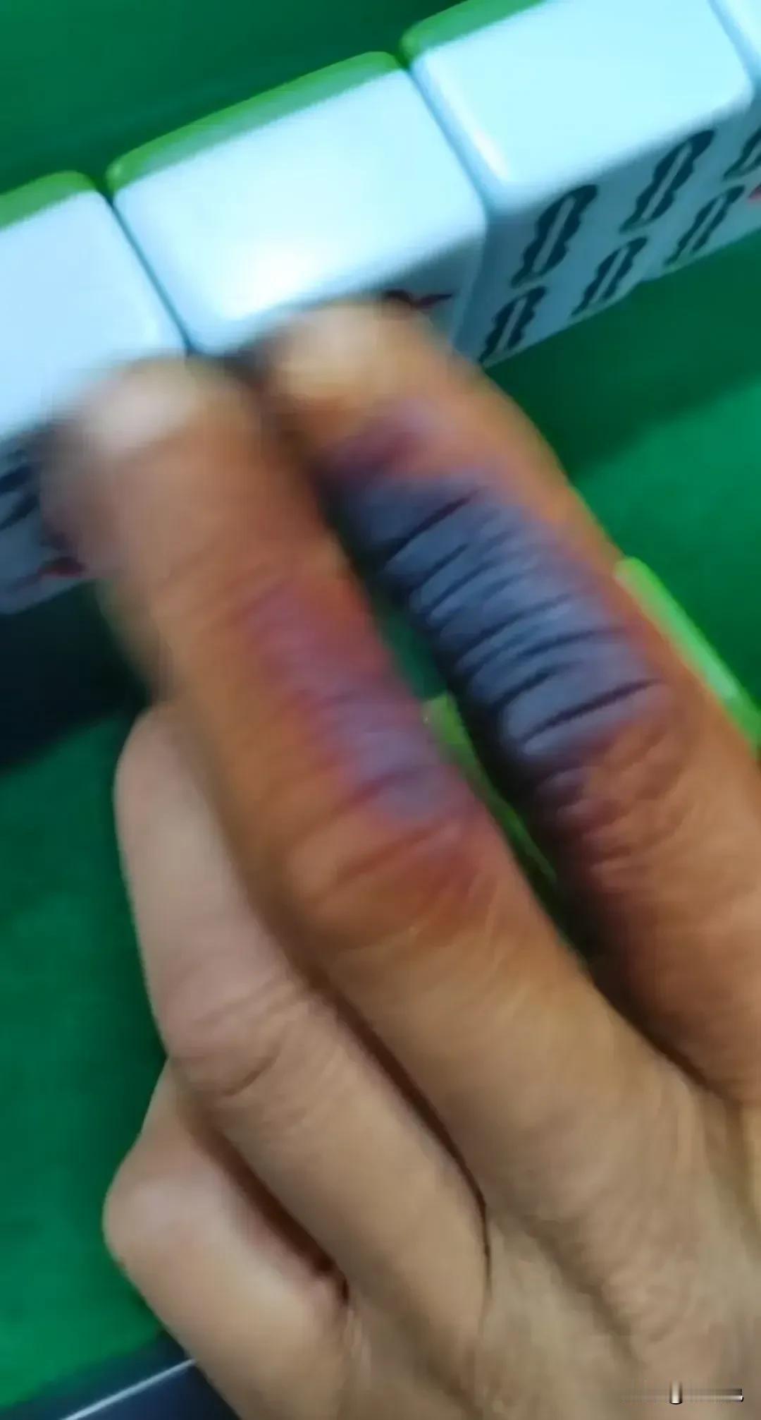 这就是一天抽4盒烟的手[泪奔]
