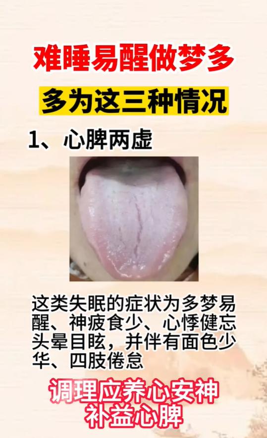 多梦易醒分 3 类，心脾两虚、阴虚火旺、心胆气虚各有表现