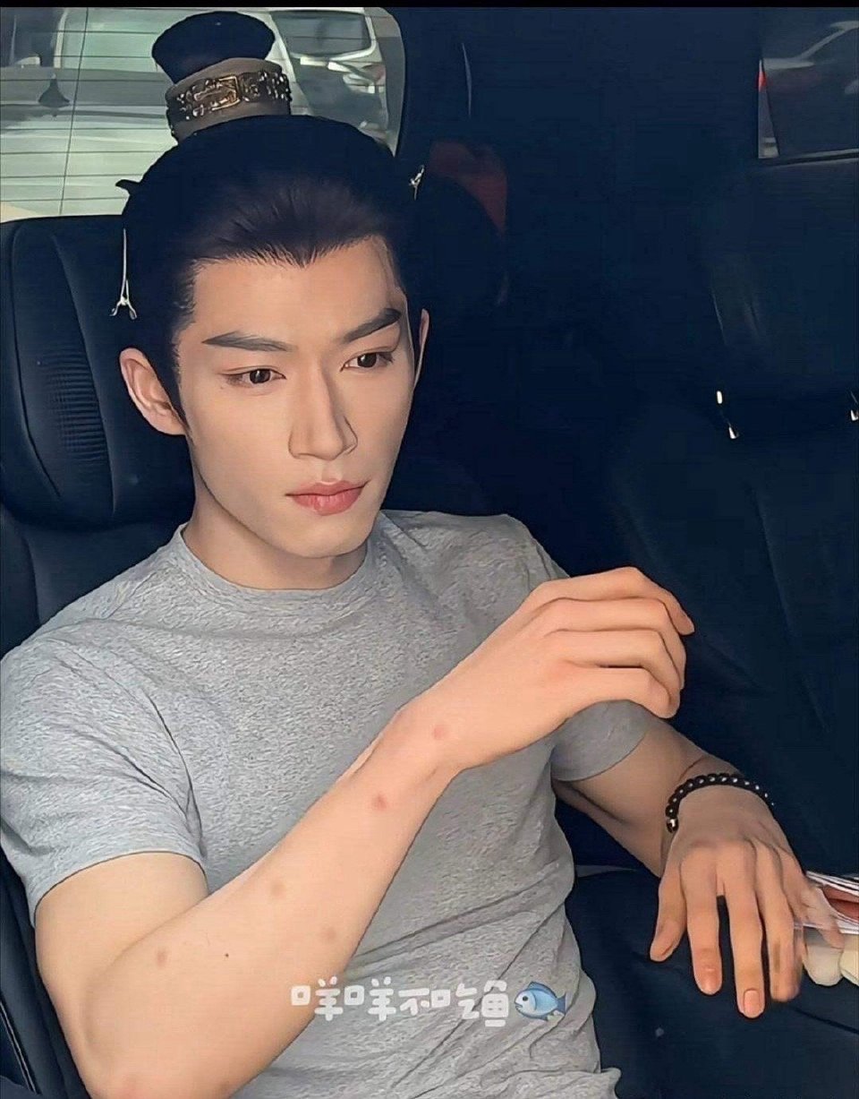 王星越身上这是咋了…… 怎么这么多疙瘩 ​​​