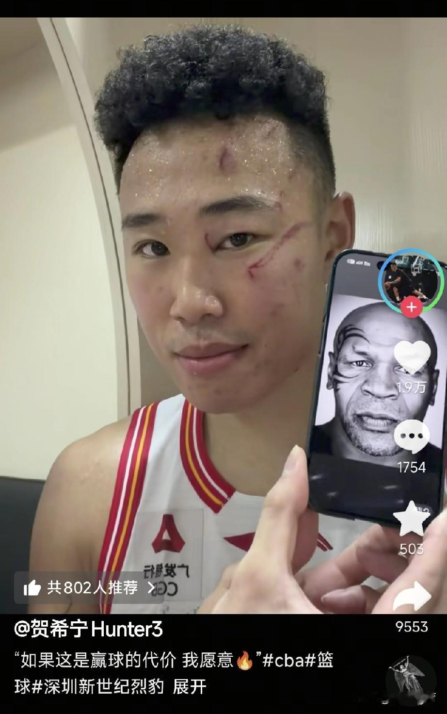 贺希宁赛后晒出受伤照，这是打篮球，还是摔跤打拳击啊？

可以看出，贺希宁这脸上的