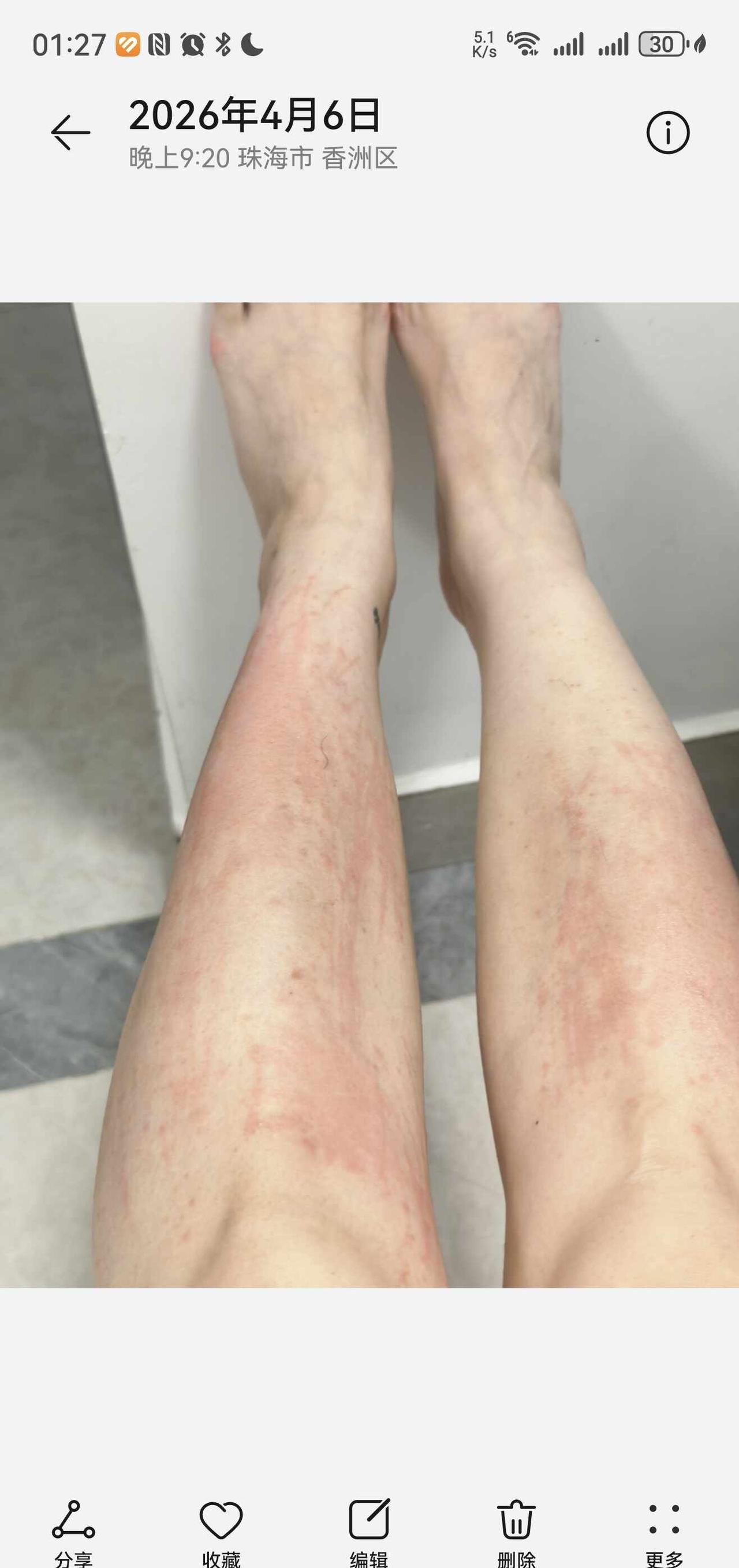 租到甲醛超标的房子过敏住院维权！
为了防止某人说我伪造事实，特地截图了拍照时间。