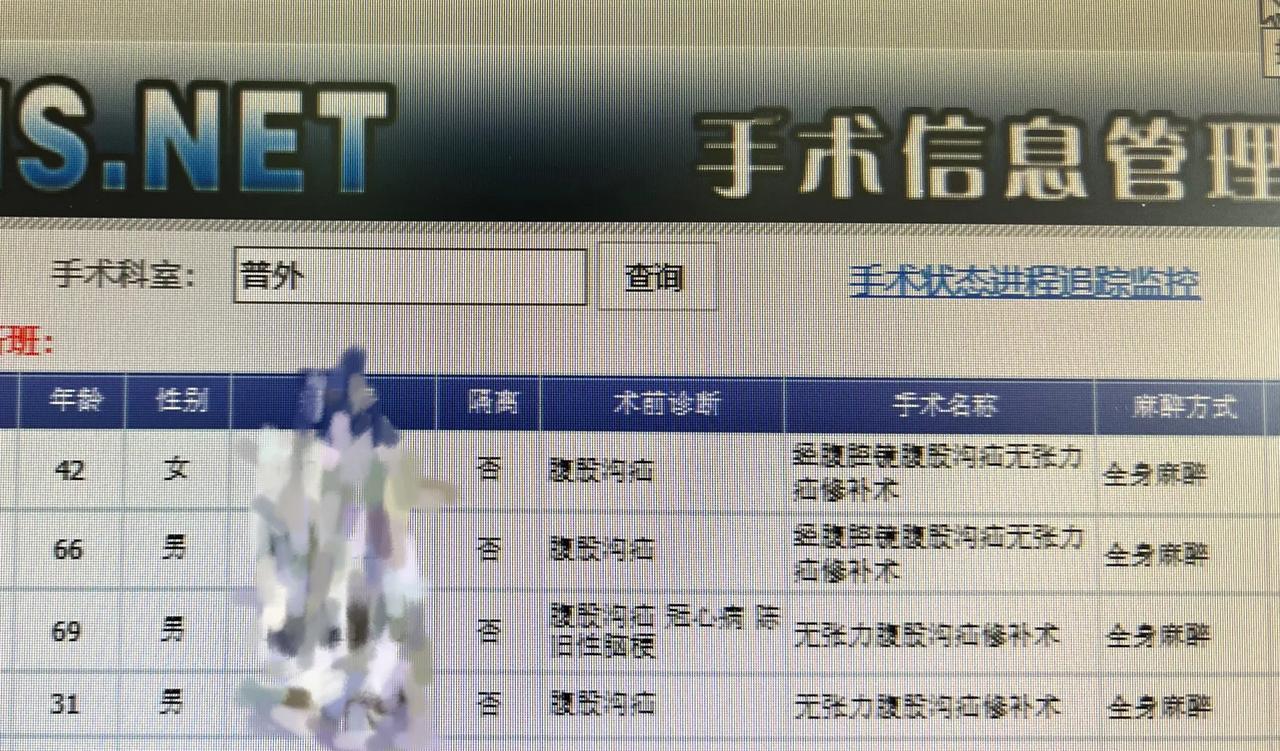 4台腹股沟疝手术结束了#腹股沟疝#