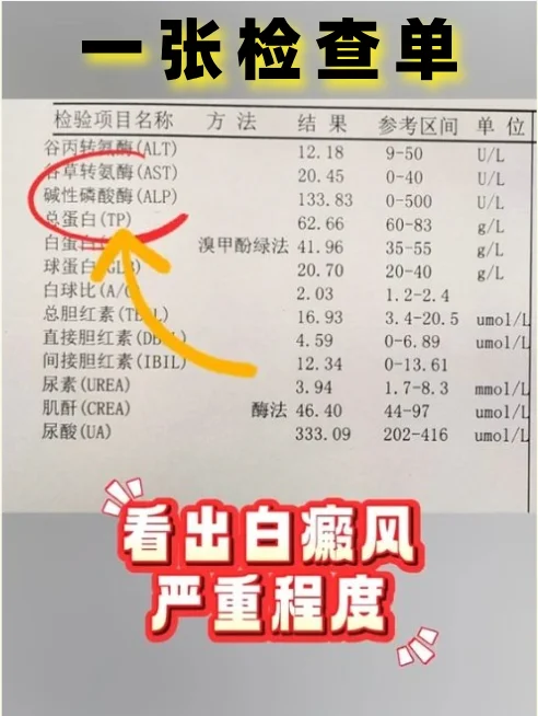 一张检查单如何看白癜风严重程度‼️看白斑