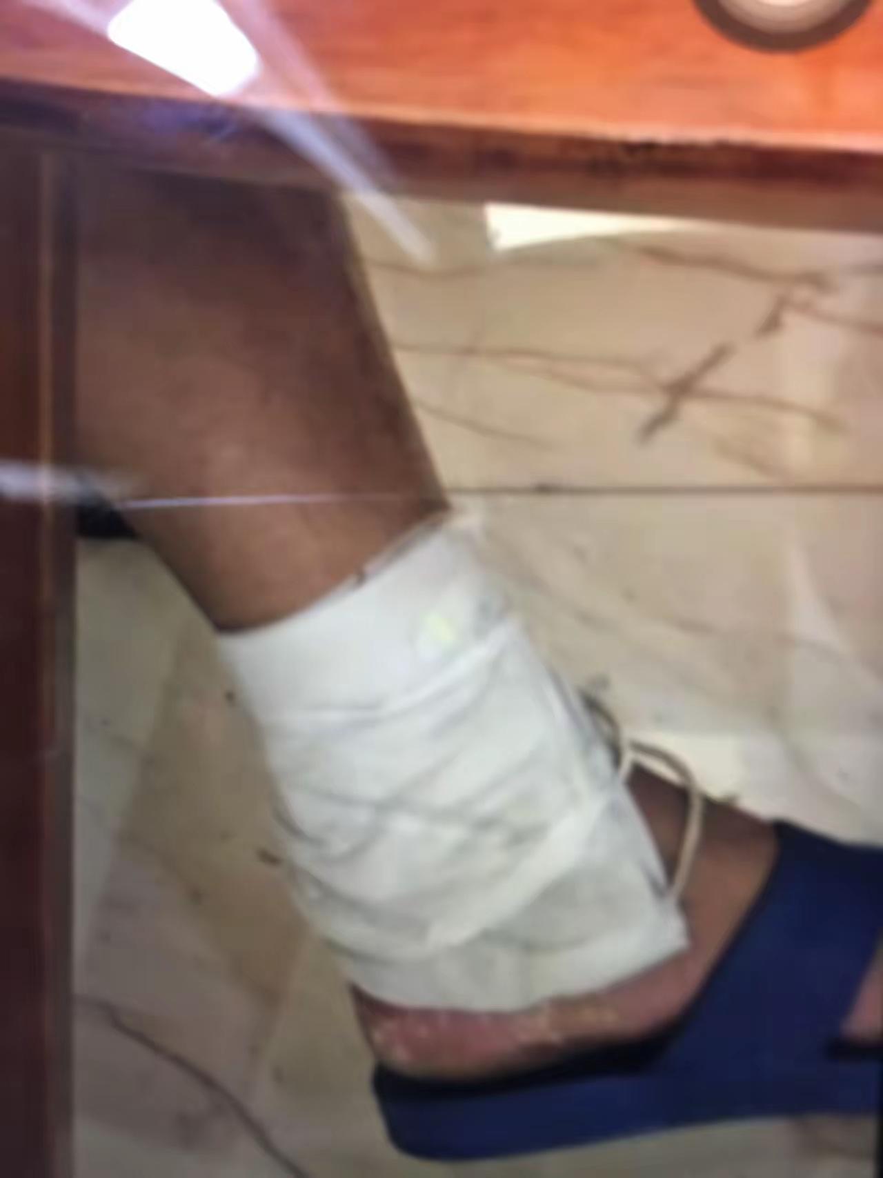 我就说小齿轮那天为什么在大师的脚踝骨不停的擦，原来大师是真的受伤了。说是大师参观