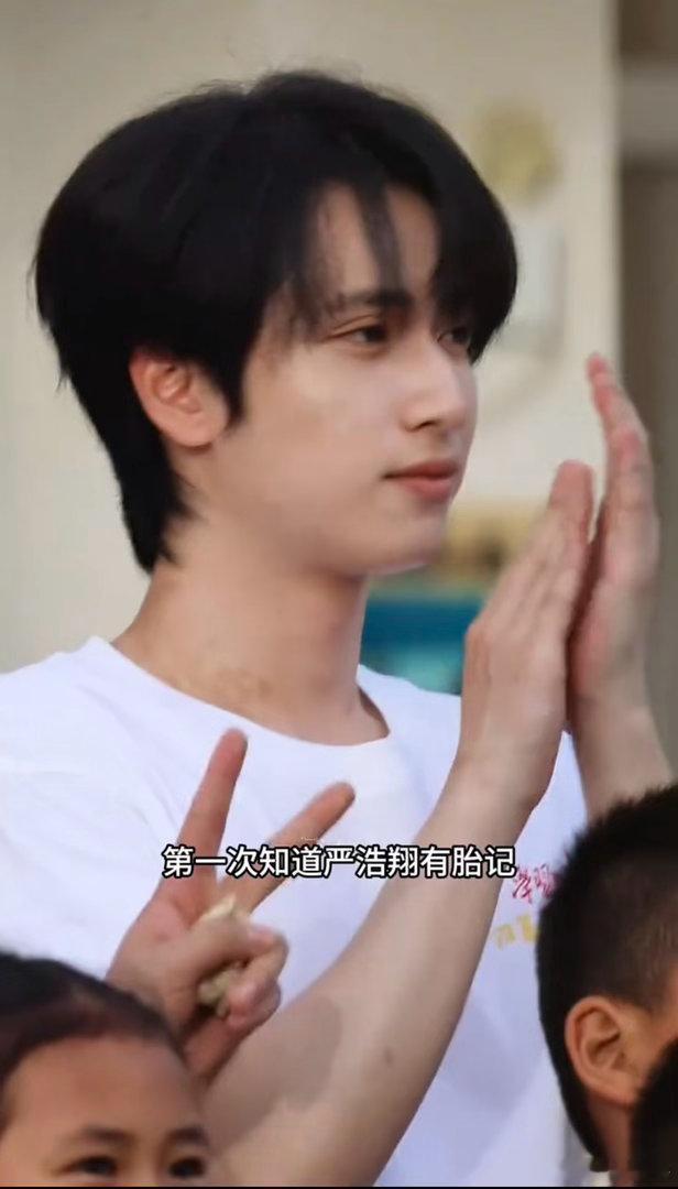 严浩翔脖子上有胎记 才留意到严浩翔脖子上的胎记！是与生俱来独一份的印记，不是瑕疵