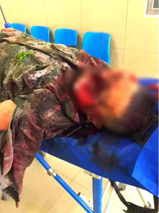 上海，一外甥带5人上门，对舅舅进行围殴，舅妈激愤之下，拿起一瓶强腐蚀性液体，直接