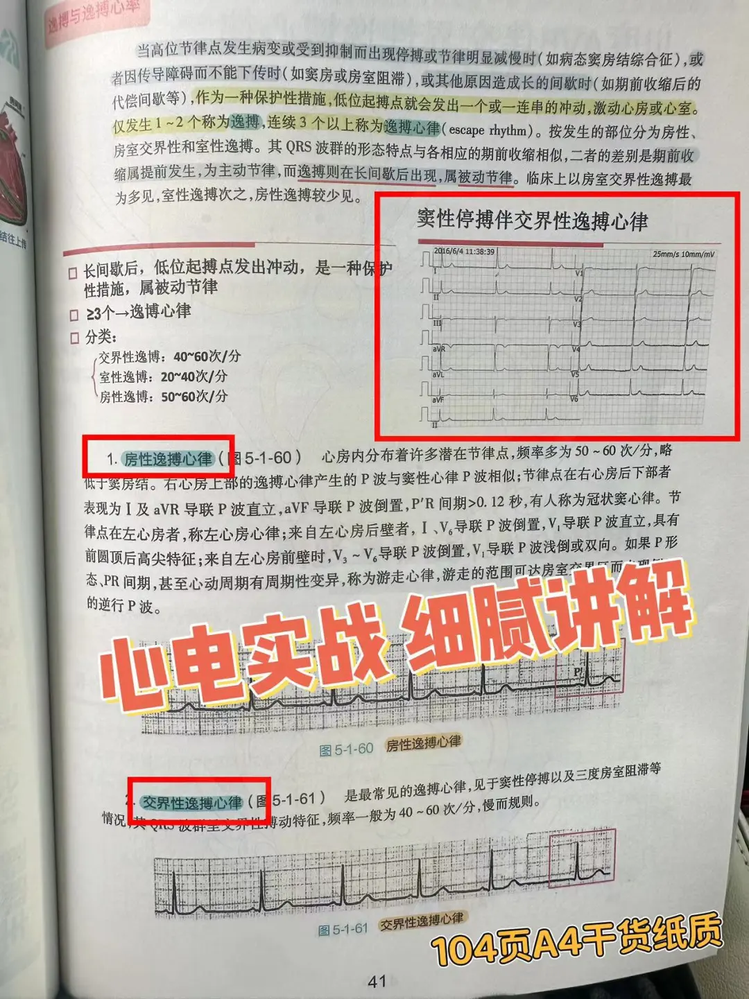 心电图实战讲解