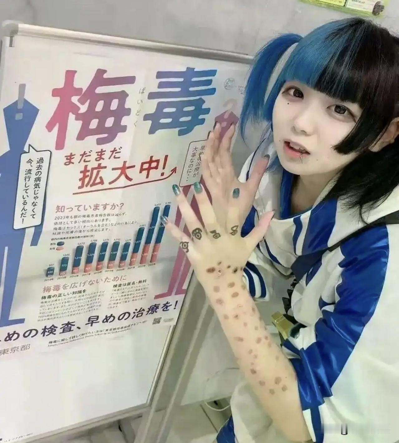 十年涨十倍，日本梅毒疫情撞上断药危机

2026年9月，日本医生收到一则通知。