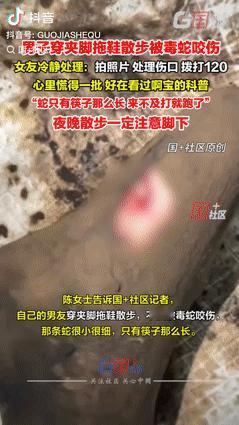 遇到贵人了！重庆，一男子穿拖鞋散步时，不慎被毒蛇给咬伤，没有应对经验的他，立马就