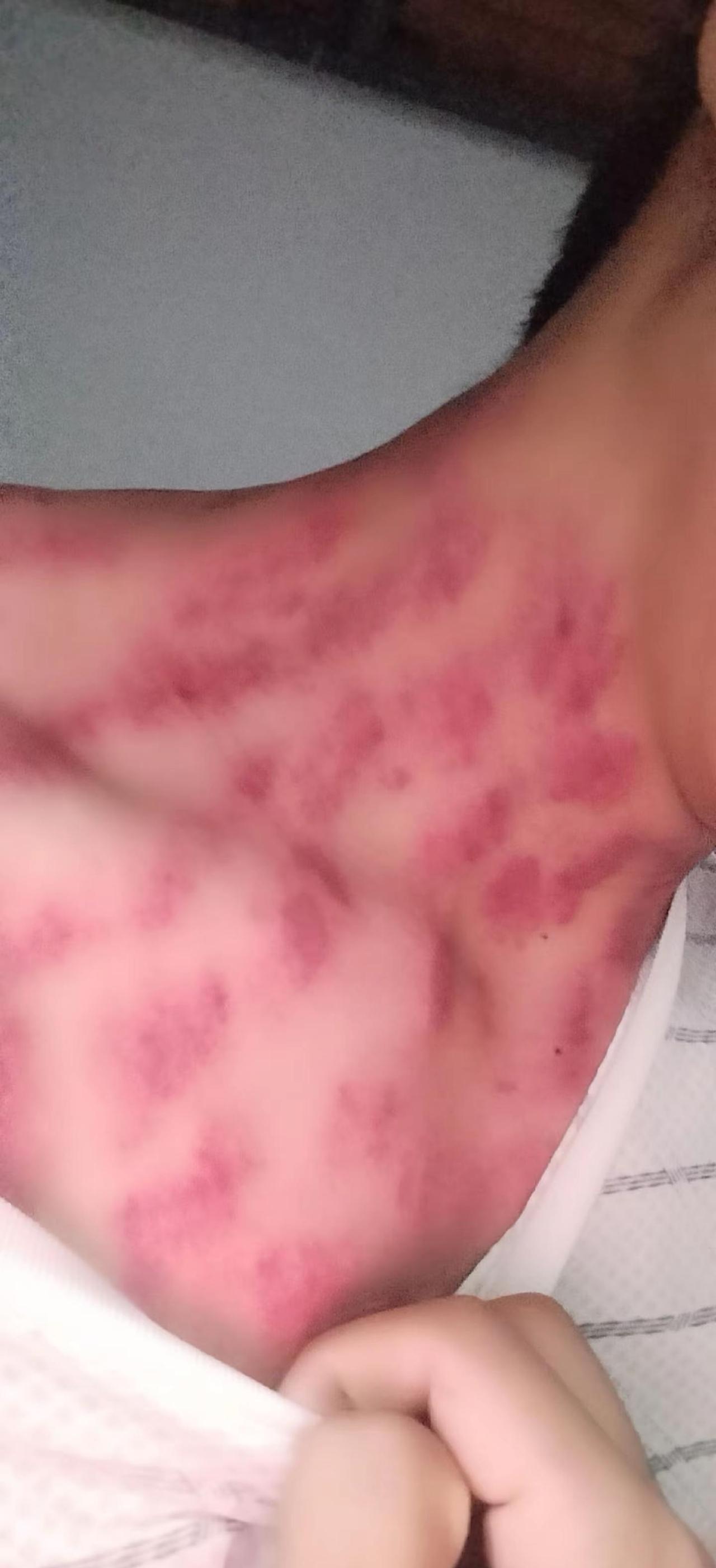 今年来刚认识一个女朋友真靠谱，生病了他还帮我刮痧，以后找老婆要找这样的女人