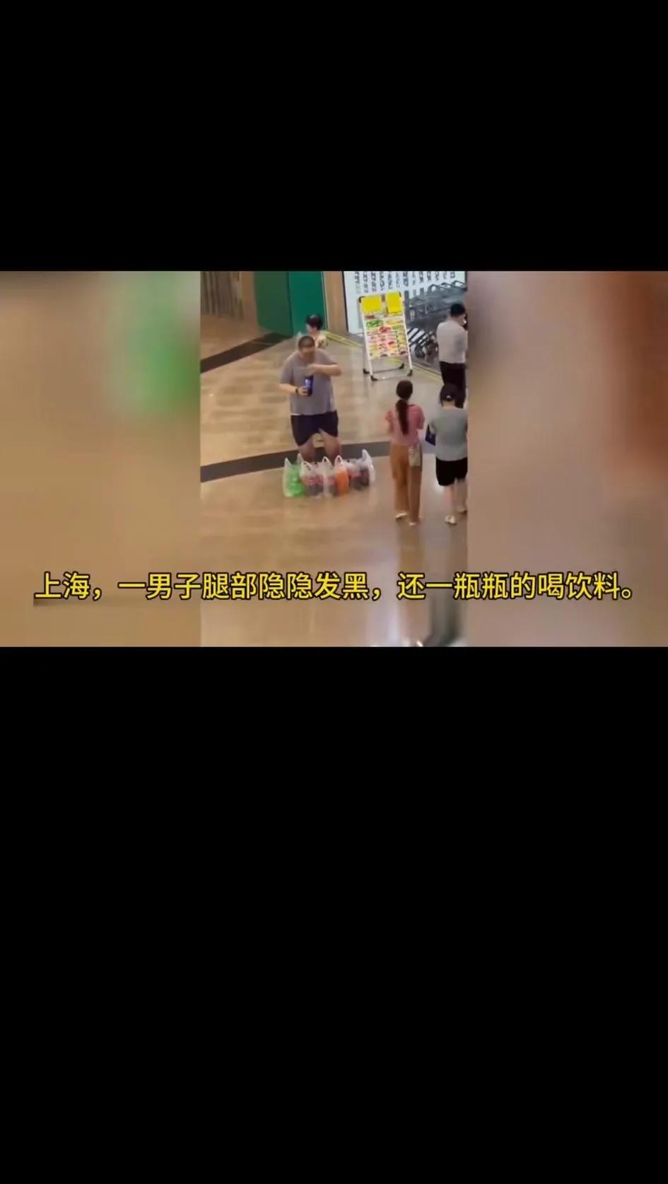 这哥们的双腿已经开始发黑了，估计血糖应该很高了！还买这么多饮料！这是作死的节奏么