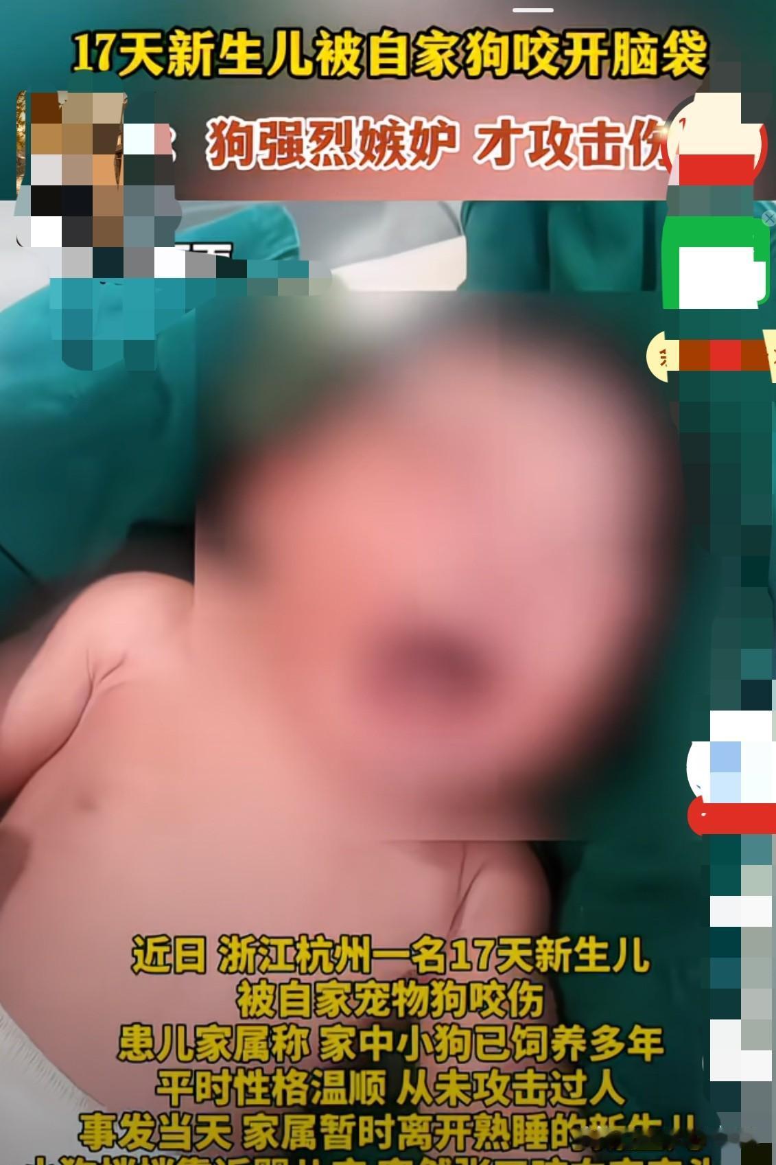 震惊！17天的新生儿被自己家养的狗咬伤了脑袋。

家属说这条狗已养多年，平时性格