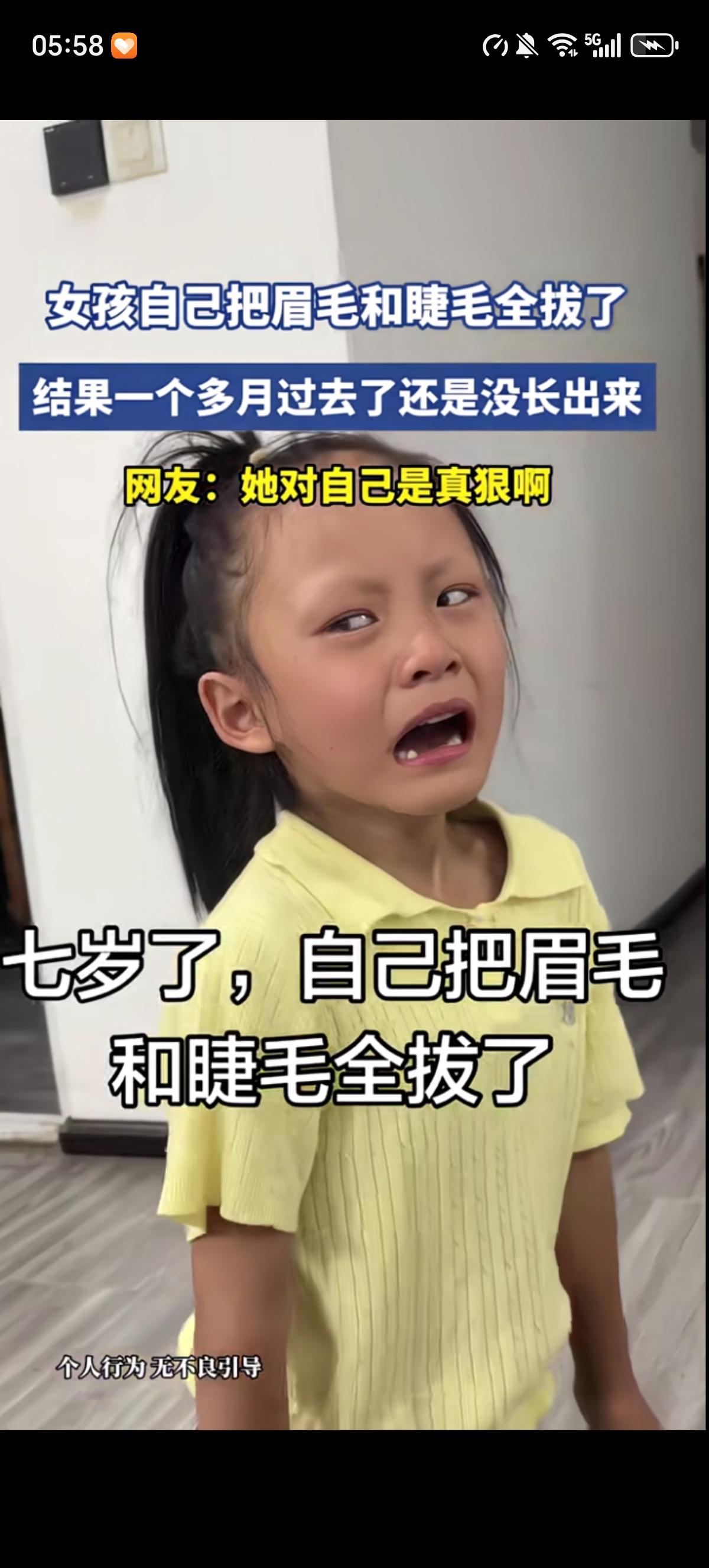小女孩7岁了，做了一个大胆的事情，就是把自己的眉毛和眼睫毛都一根一根的拔掉了，也