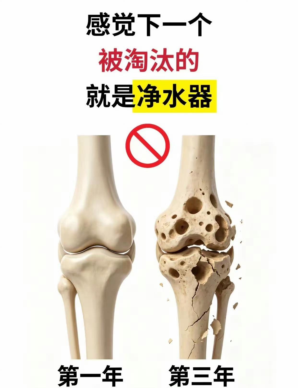 感觉下一个被淘汰的就是净水器。

也不知道真假…
《入行净水十六年，我经手检修过