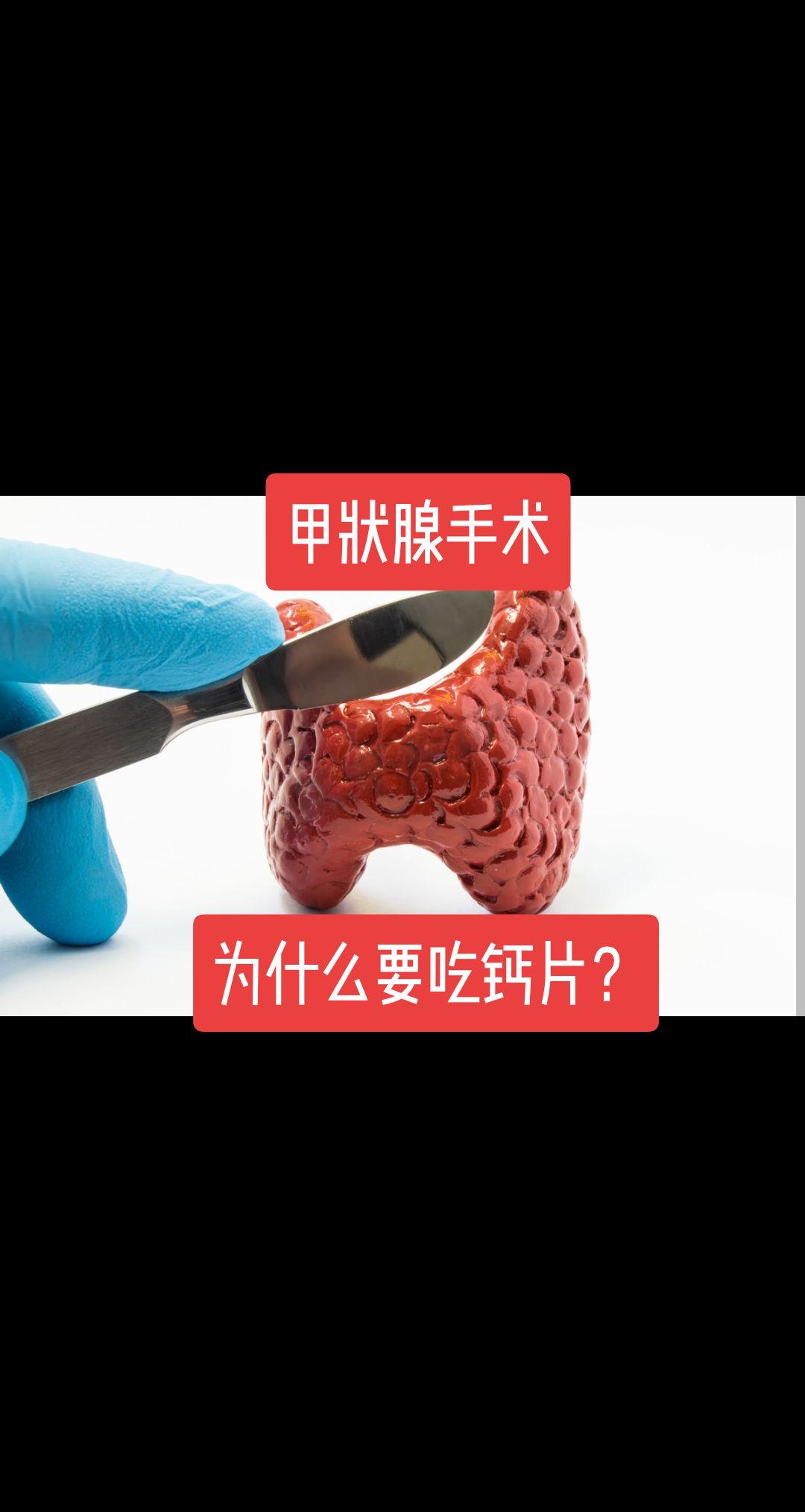 甲状腺手术，为什么要吃钙片？🍁🍁🍁🍁🍁🍁
甲状腺癌手术后，不少人需要一直吃优甲乐。很多人叫苦不迭。
有些人却还要吃钙片，钙片还不能跟乐乐一起吃，要分开吃，还担心长结石。
🍁🍁🍁当患者遭遇双侧甲状腺手术，特别是双侧癌，淋巴结转移较多，医生需要尽可能手术彻底切除肿瘤，有可能会导致甲状旁腺功能短时间内、甚至永久减退可能。从而会引起血钙降低，导致手足麻木，严重者会抽搐。
这时，补钙非常需要引起重视。
其实，有必要提醒一下，需要长期服用优甲乐的患者，优甲乐的一个副作用就是加重骨质疏松。所以建议长期吃