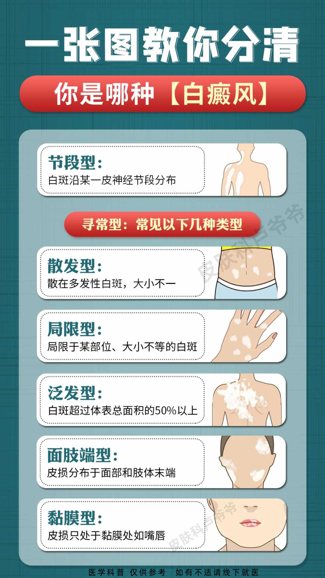 白癜风 白斑 医学科普  江西
