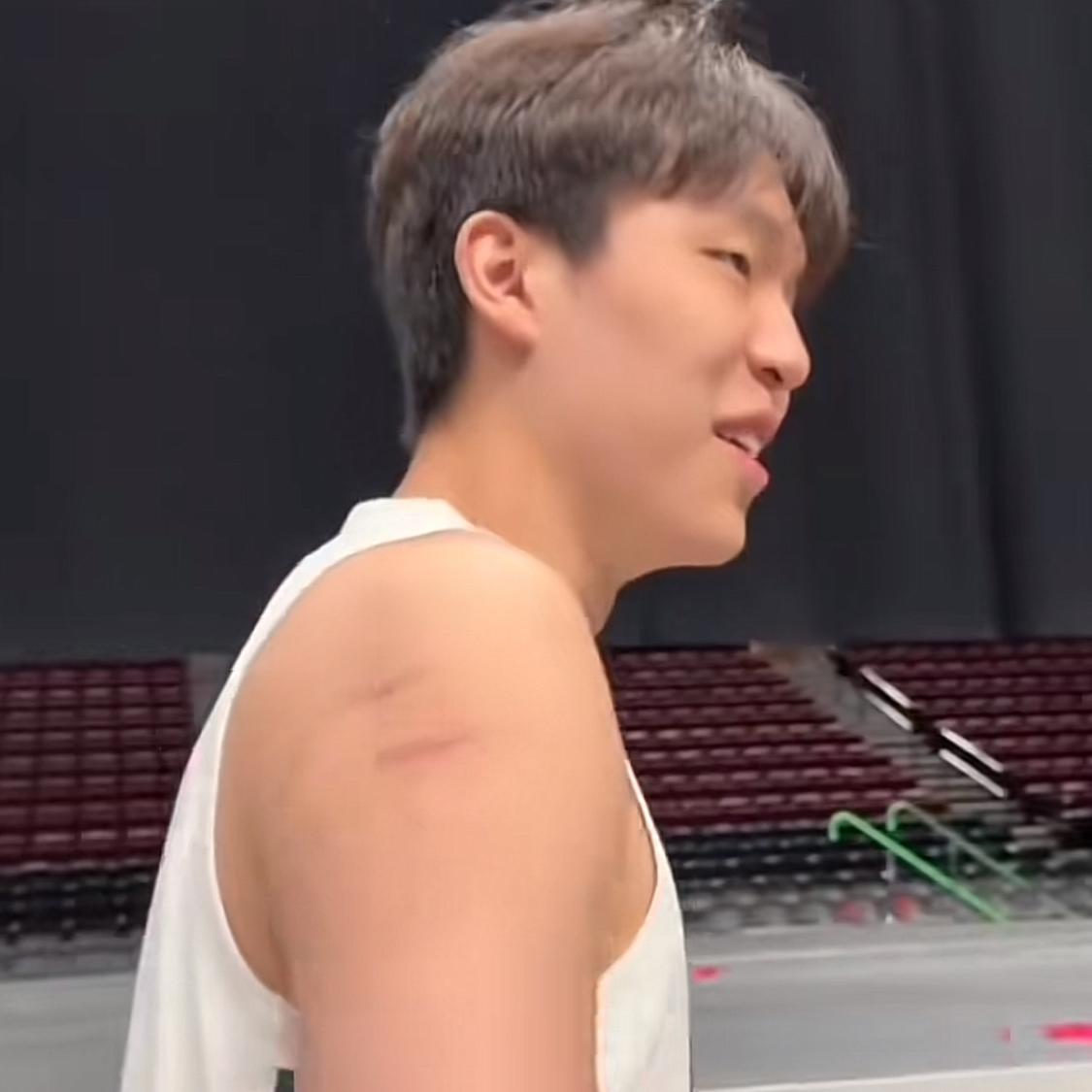 杨瀚森手臂上的抓痕还在！今日NBA新赛季媒体日，杨瀚森现身媒体日并拍摄了定妆照。