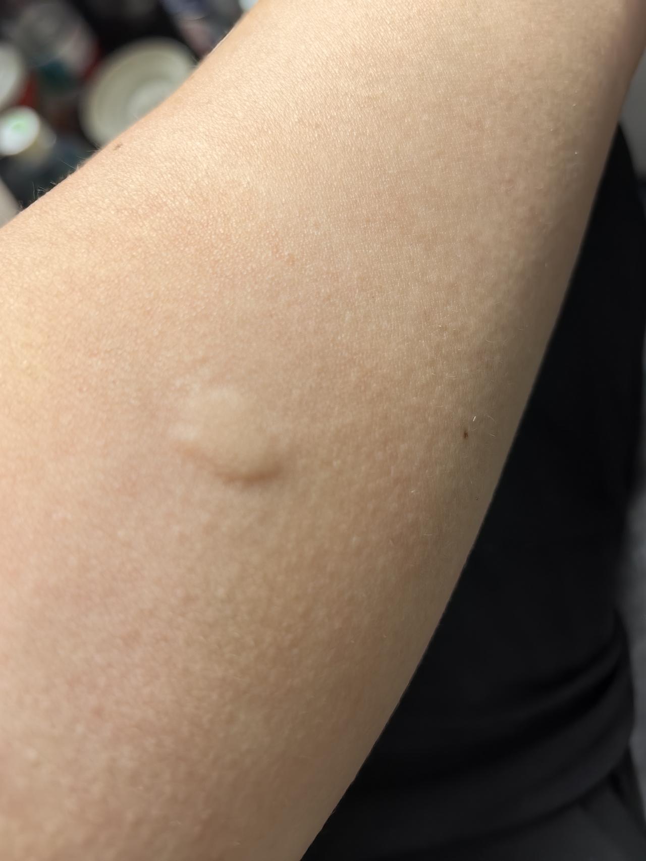 啊有什么好的办法？我太容易被蚊子咬了
摘了一串葡萄，就被蚊子咬了个大包！
我现在