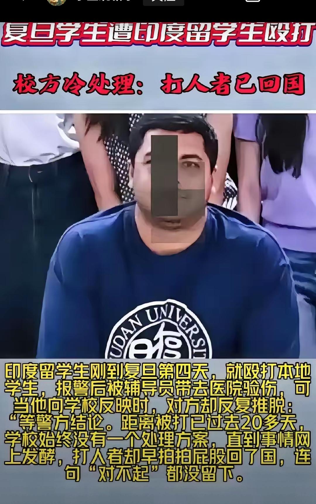 复旦外籍交流生锁喉殴打本校学生这件事，最让人寒心的从来不是打架冲突，而是截然不同