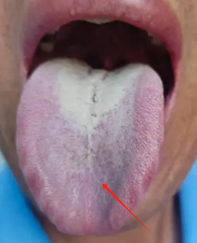 你知道吗？有些舌象不仅反映了我们的身体健康状况
还可能无意间透露出我们在夫妻生活