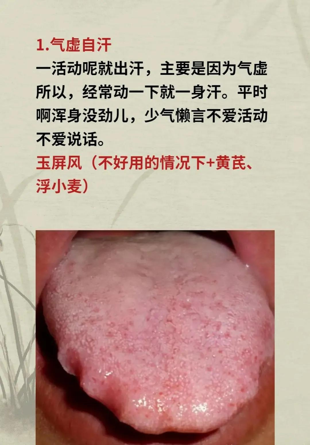 你是不是经常出汗，不管是额头、手脚还是半身，总是汗流不止？这可能是身体给你的信号