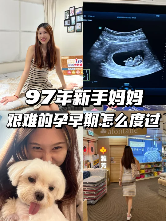 有没有和我一样孕早期每天嗜睡12个小时…