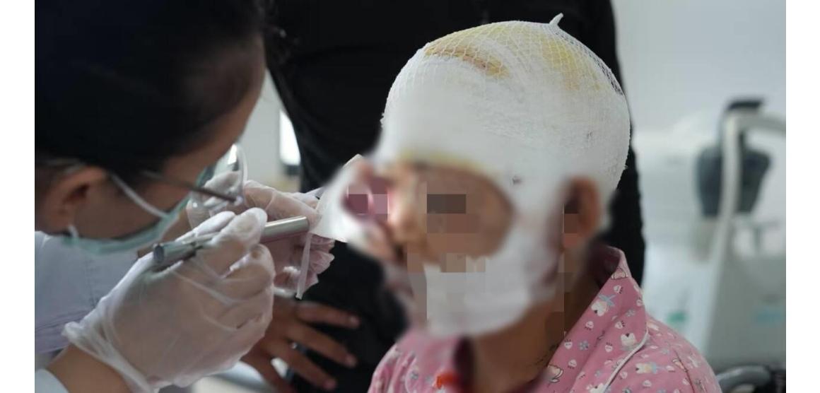 22岁孕妇牧区遭熊突袭，装死自救 右眼毁损但保住腹中胎儿

甘肃牧区突发熊袭震撼