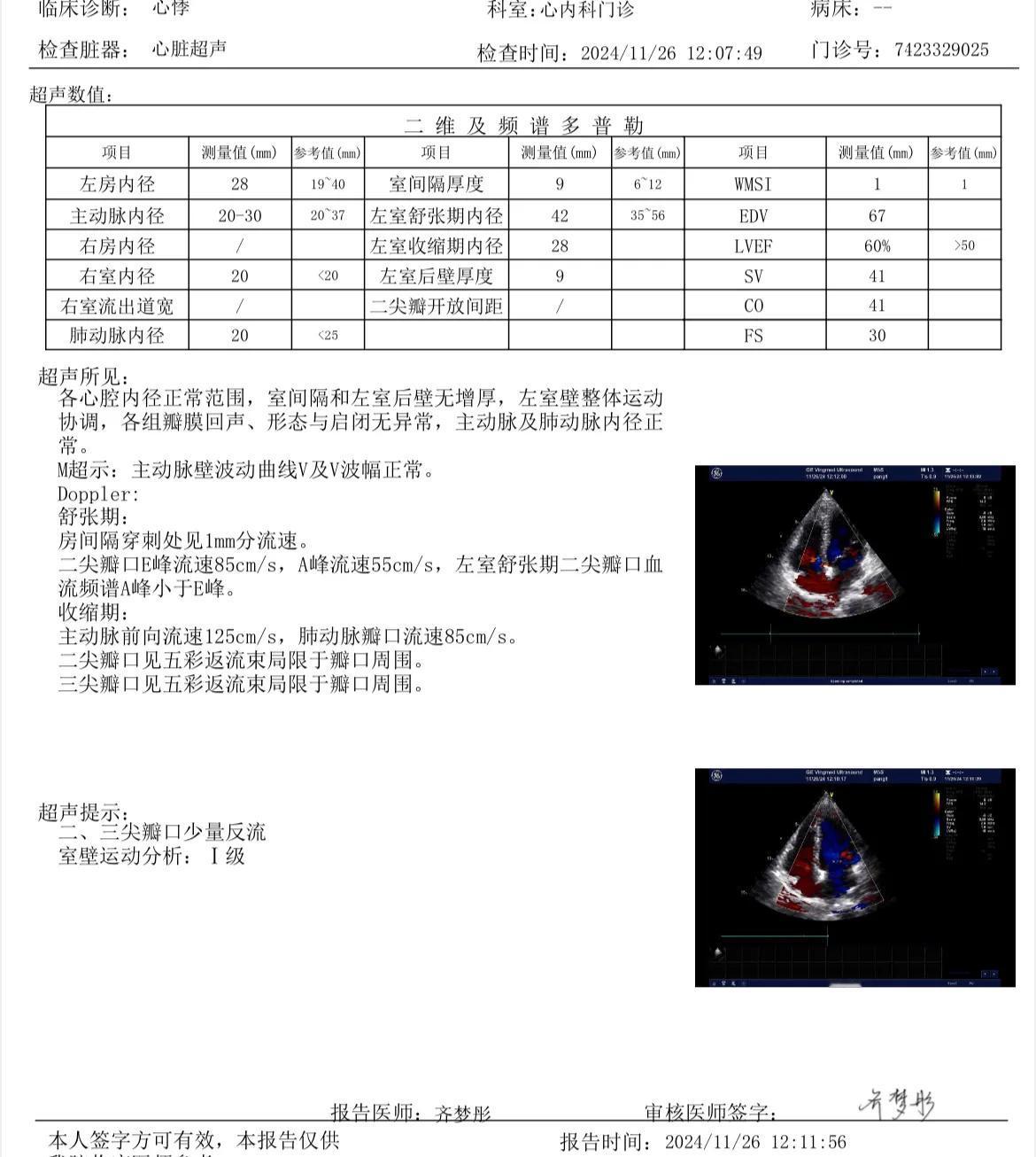 4月份我因频发早搏做了心脏射频消融治疗，前两天去复查了心电图和心超，这应该算是彻
