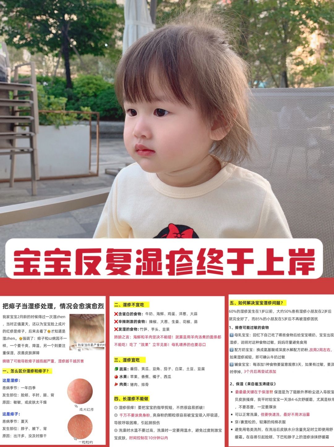 宝宝湿疹｜病因症状及护理方法‼