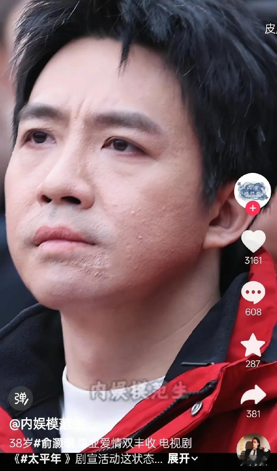 刚刷到这个视频，俞灏明脸上的皮肤细节……这是怎么回事？