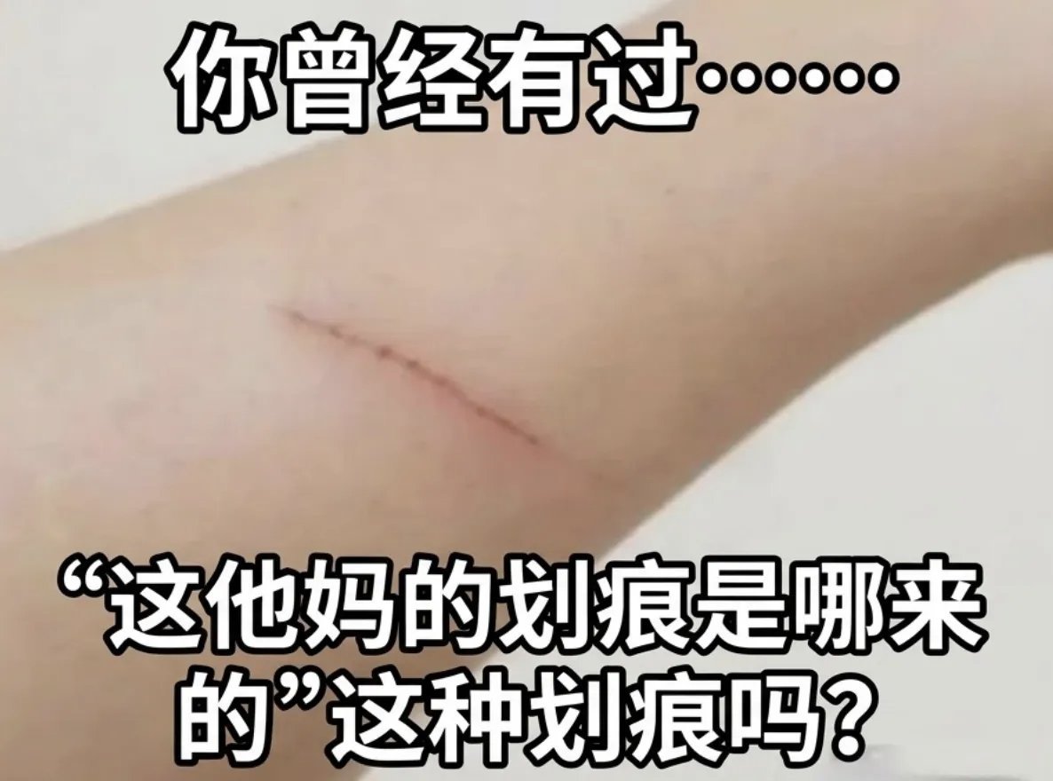 妈呀我醒来的时候手臂上有一道 而且还特别痒 
