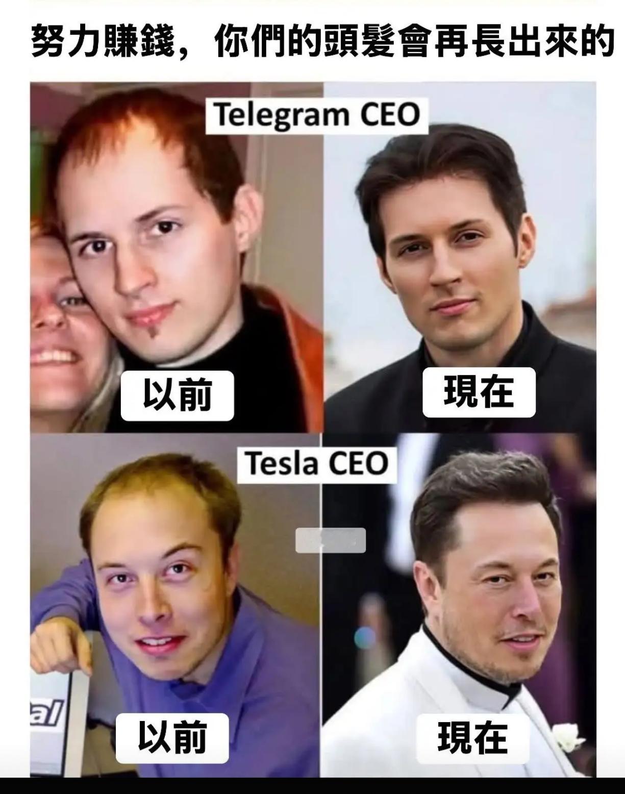 努力賺錢，你們的頭髪會再長出來的 ​​​