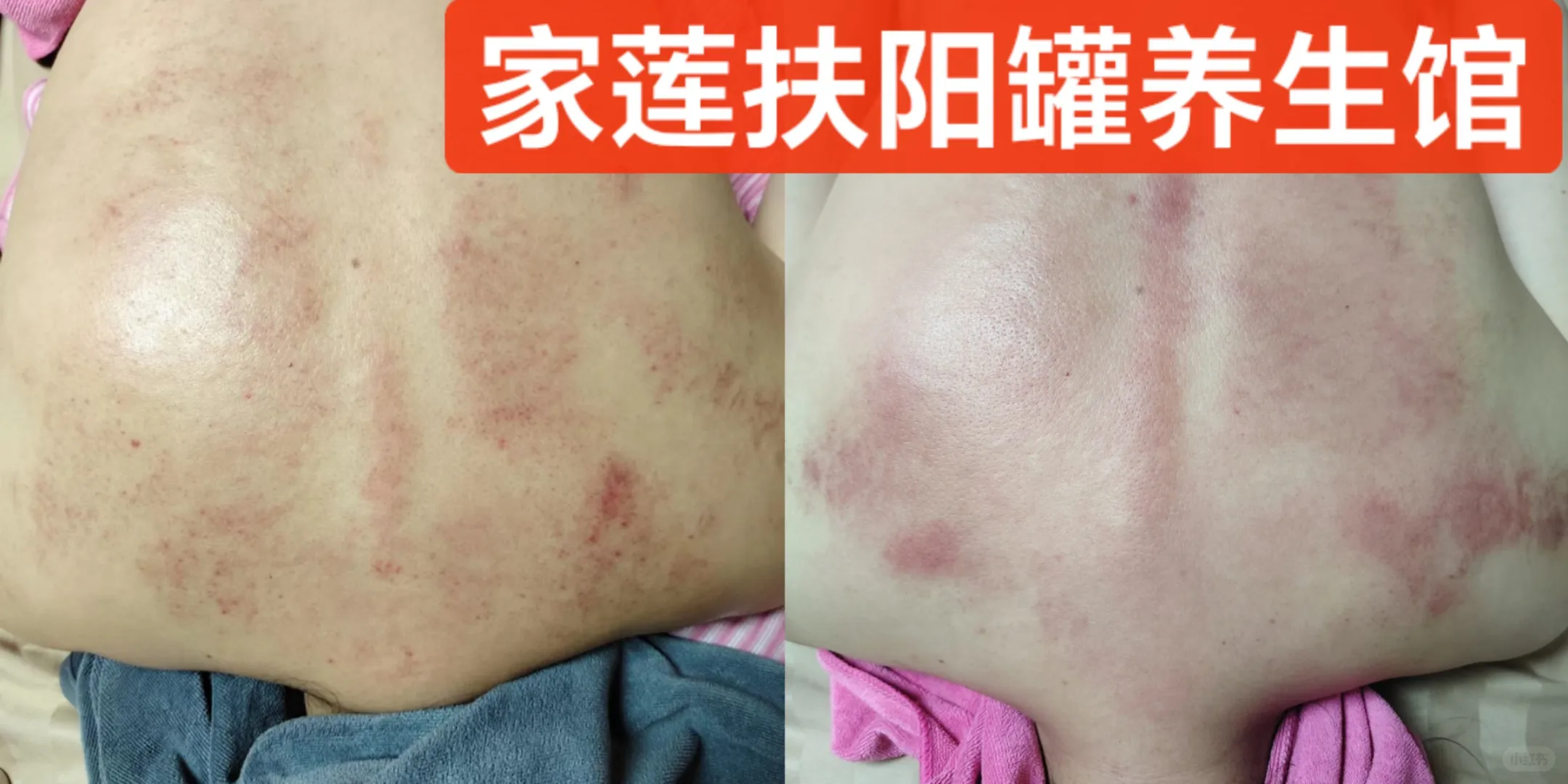身体越来越好，哪里有祈祷就行。付出行动才