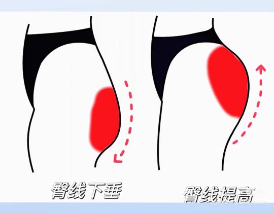 硬拉和臀推练哪个好？