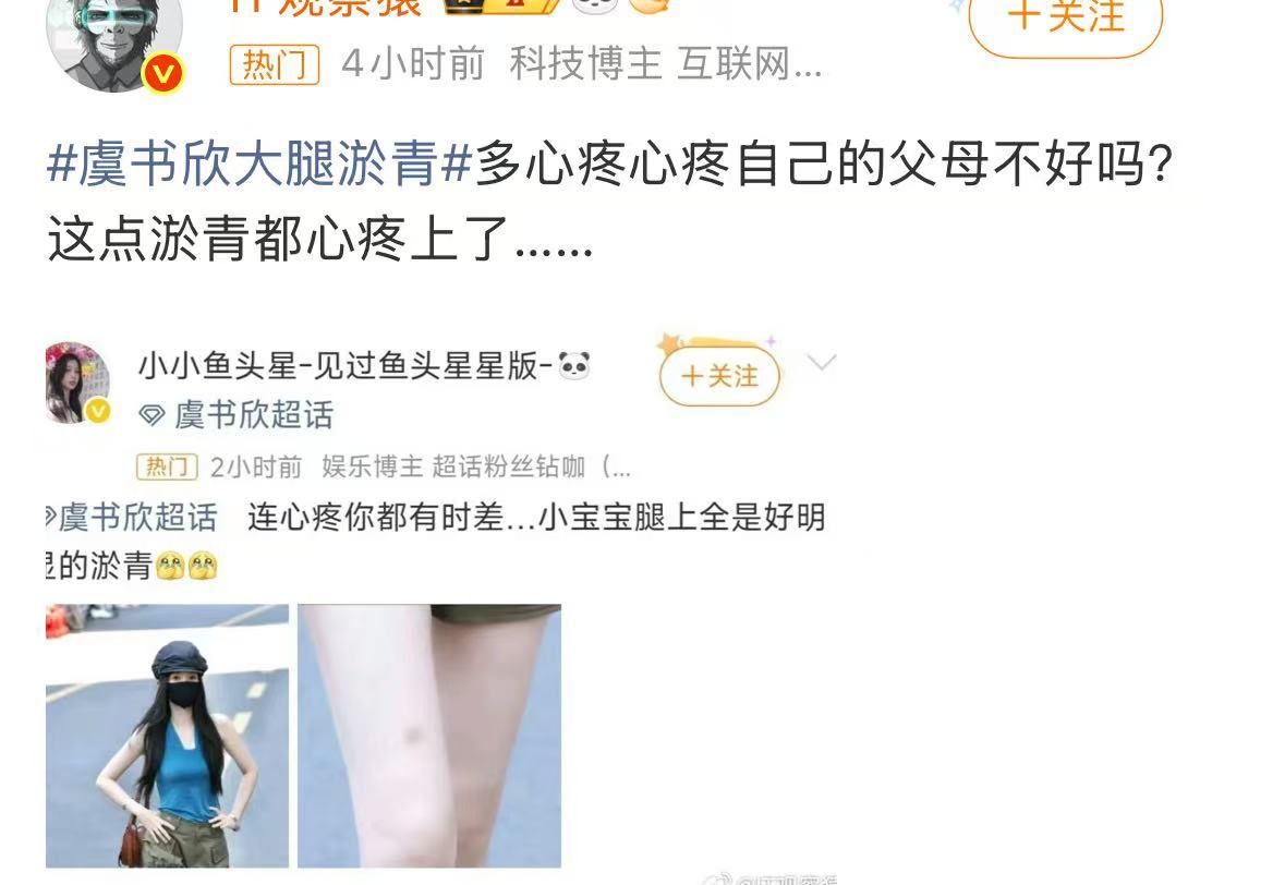别家心肝受伤：好心疼 有没有事啊哥哥虞书欣受伤：这点淤青也心疼合着我的心肝就不是