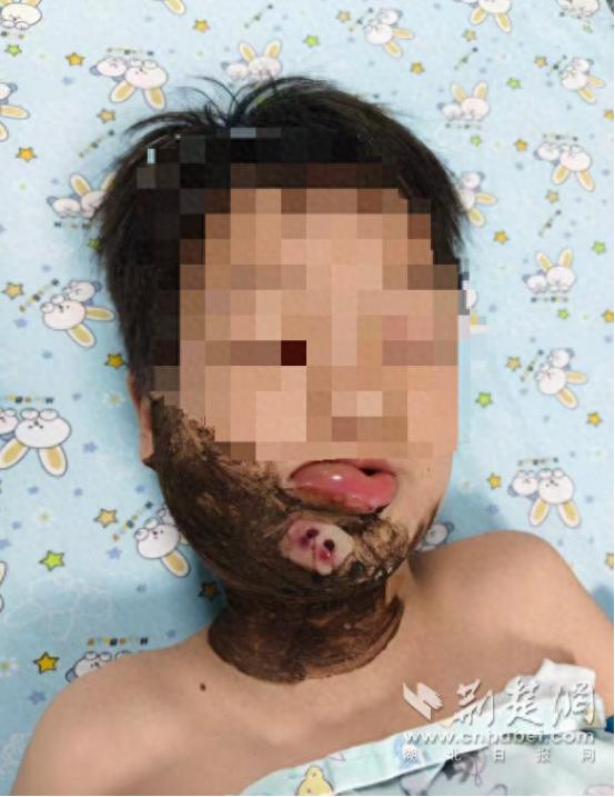 悲剧还是发生了！湖北襄阳，一8岁男童傍晚在浅滩踩水嬉闹时，一条细长黑影猛地从浑浊