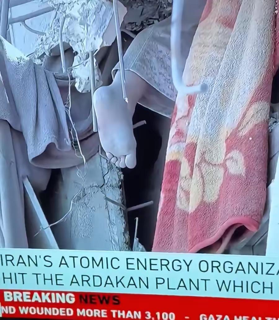 炮弹可以摧毁一座座房舍
废墟可以掩埋所有的罪证
但这只脚却永远留给世界
它在无声