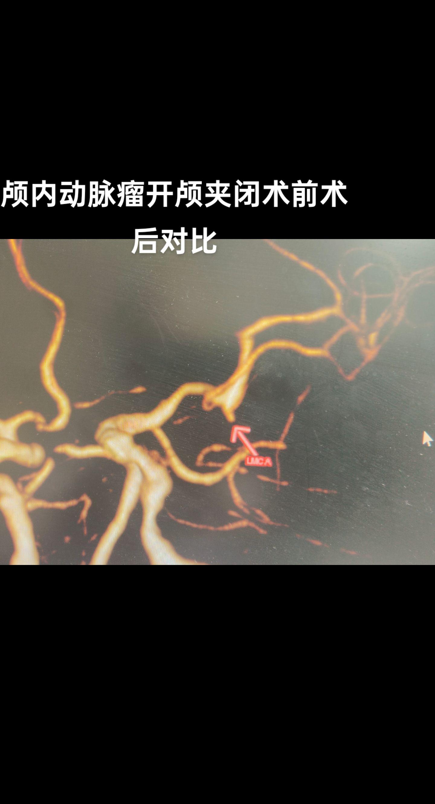 医者仁心 手术室日常 医学影像 医生日常