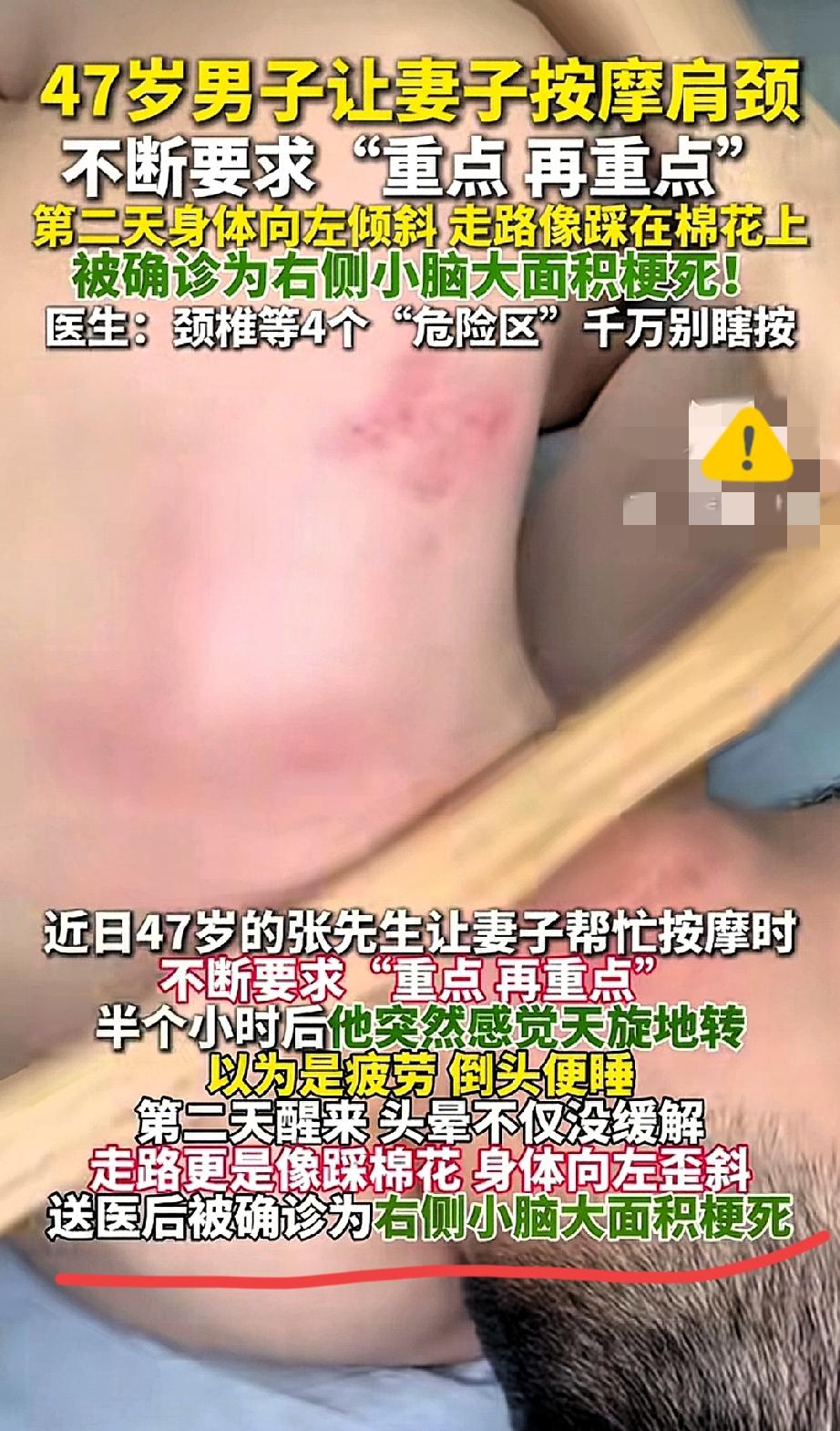 喊老婆按肩颈“再重点”！47岁大哥醒来竟走不了路！
 
让老婆按脖子喊“再重点”