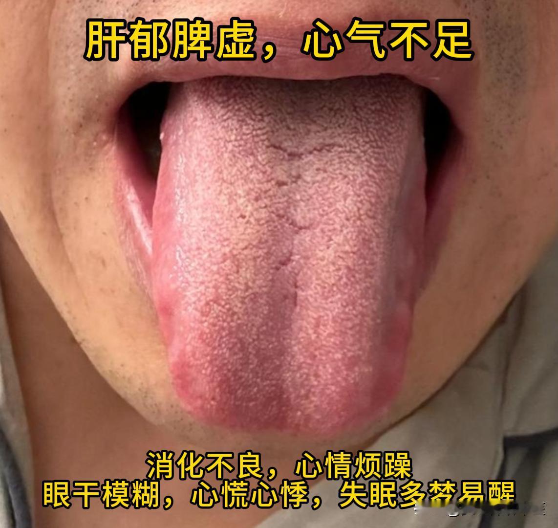 今天有时间，可以帮大家看看舌象。

有需要的，尽管把你的舌象照片发过来吧！越早发