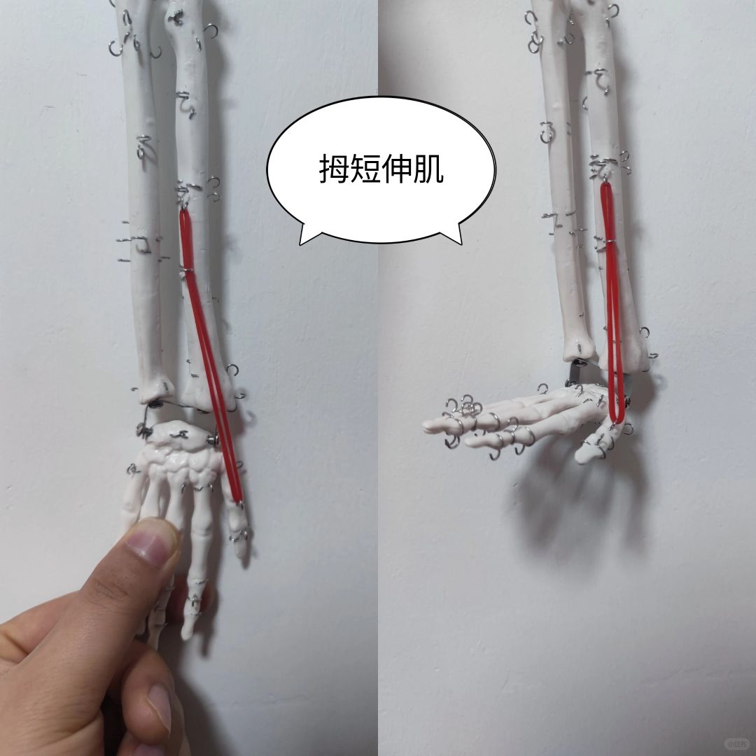 拇短伸肌