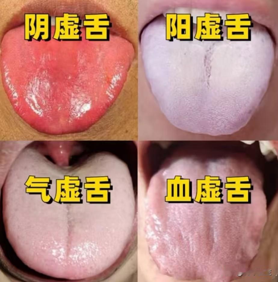 从舌头看健康，你来拍，我来看！

挑战帮粉丝看舌象，你敢发，我就看，帮助大家减轻
