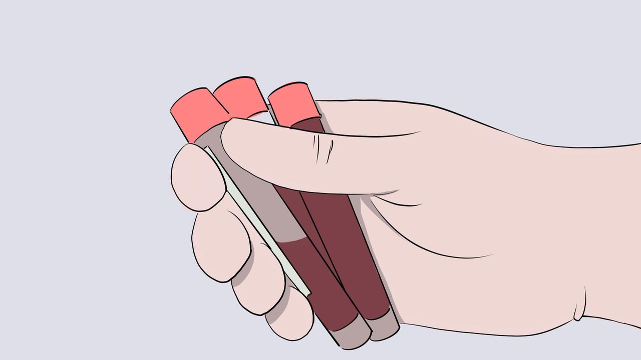 久坐小腿肿胀是什么原因，与血液病有关系吗

久坐小腿肿胀，可能是由于坐姿不好、寒