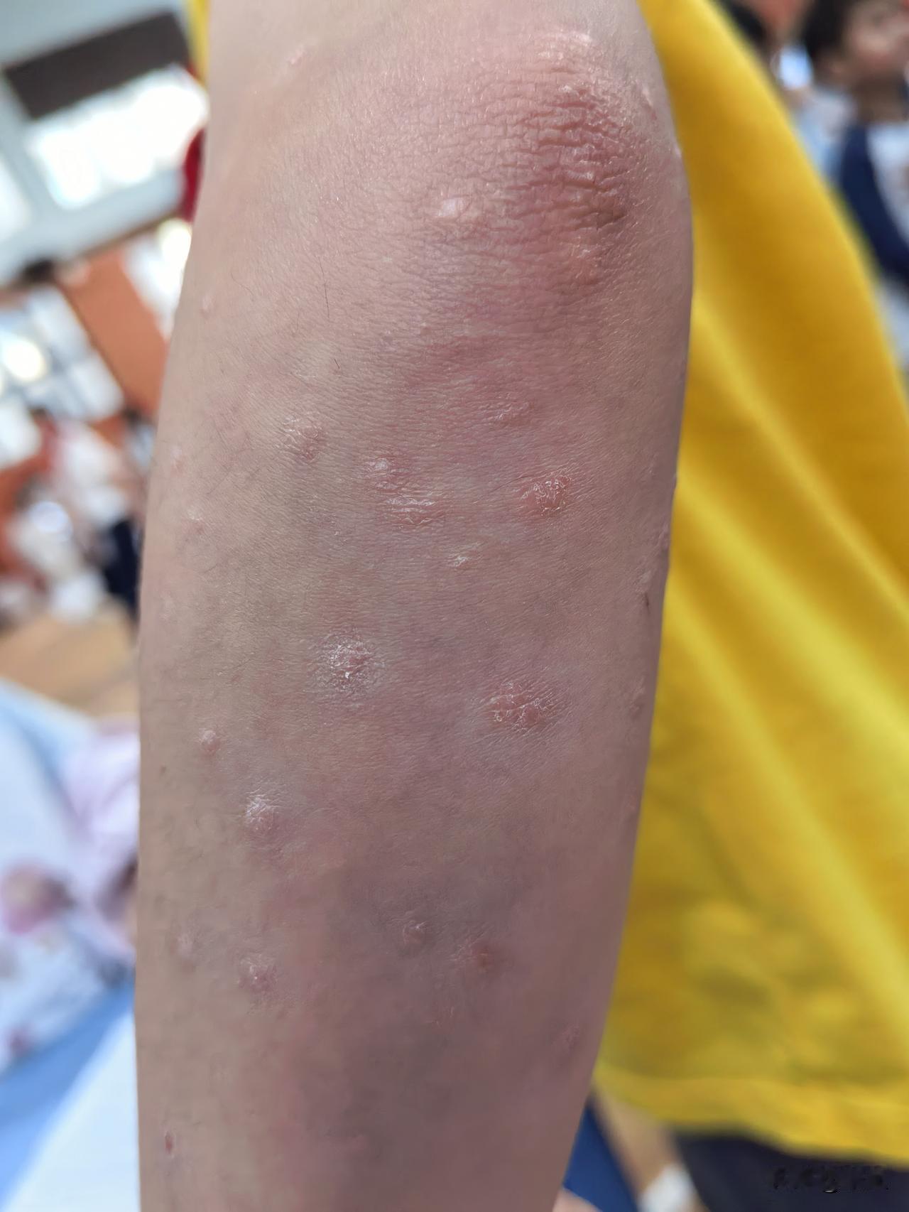 发什么呢？前晚夜班，差不多三点才睡，昨天白天没补眠，昨晚十二点就睡了，今早八点多