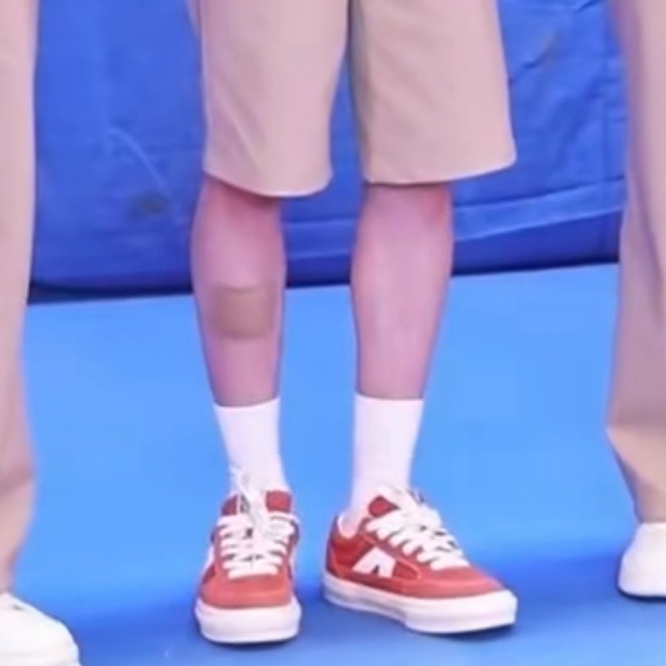 小狗的腿怎么了，是不是之前那道很长的疤痕