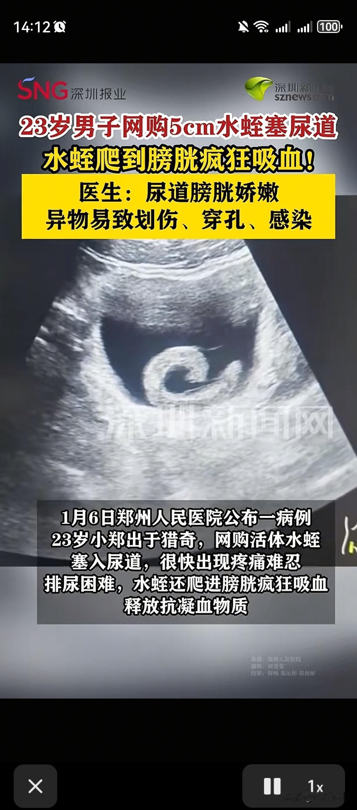 “再也不敢了”
近日，河南郑州一名23岁的男子闲着太无聊了，在网上认识了一些网友