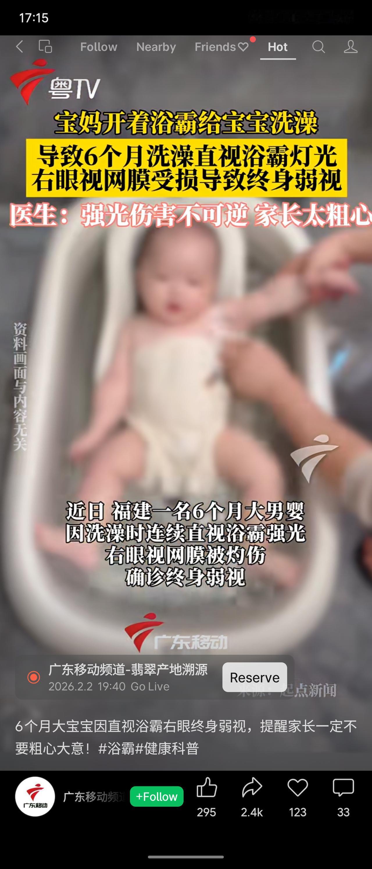 福建一名6个月大男婴洗澡时连续直视浴霸强光，导致右眼视网膜被灼伤，确诊终身弱视。
