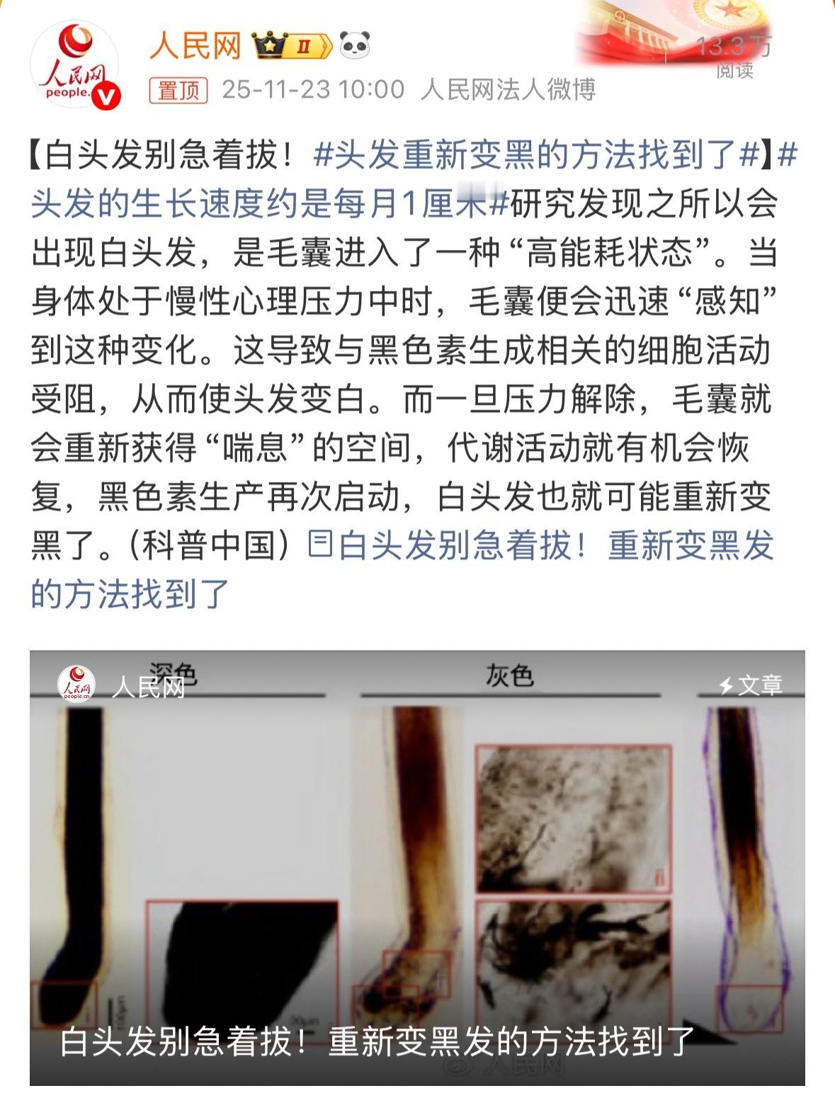 人民网说了，缓解压力让心情放松白头发说不定就会悄悄地变回来，大家有事儿一定别往心